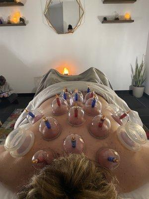 Bio magnetic cupping