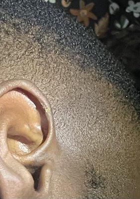 My ear cut