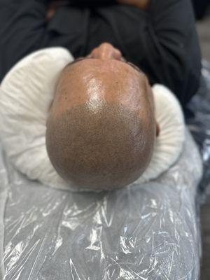 SMP Scalp Micropigmentation CA hair tattoo