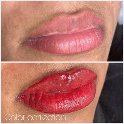 Color correction is a procedure to remove the darkness of the lips.