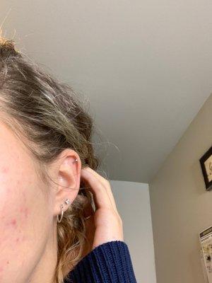 Cartlidge piercing on left ear.