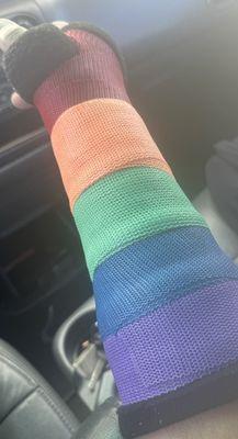 My beautiful colored cast!