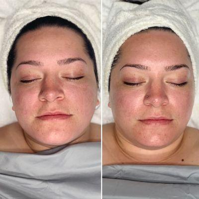 "The Natal Being" (customized facial) Great for first time facials!