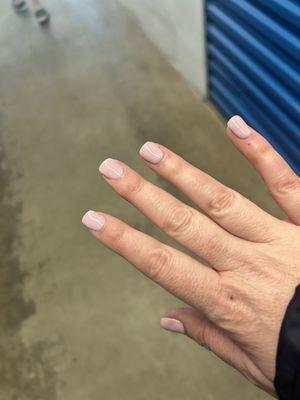 Pinky finger bumpy and uneven.