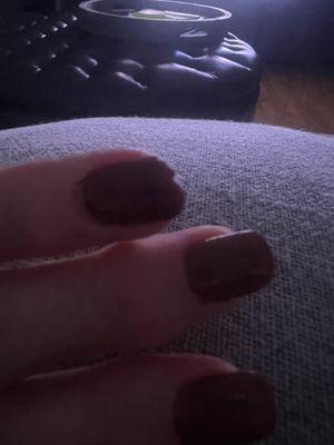 Broken nail