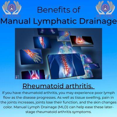 MLD can help if you suffer from Rheumatoid Arthritis.