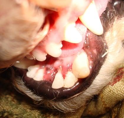 Front of mouth where the only tooth that needed extraction was pulled. Other teeth are shown after cleaning and polishing.