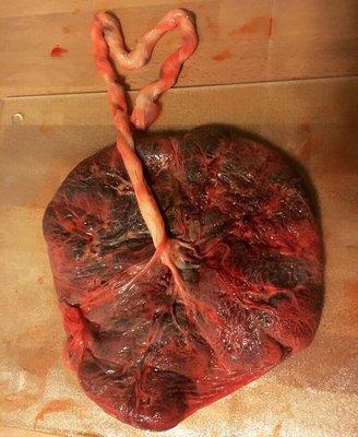 The beautiful placenta