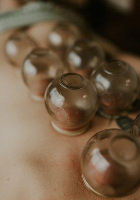 Cupping therapy