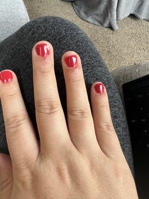 Chipped manicure within 24 hours and scabs around nail beds