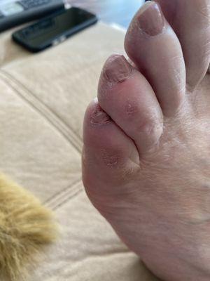 Results of the pedi and a cut toe!!