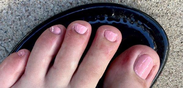 Cuts on the far right three toes below and next to the nail