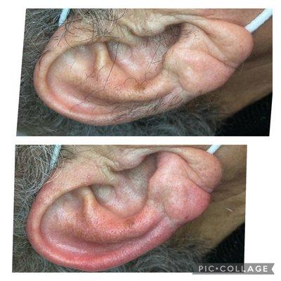 Ear waxing for men