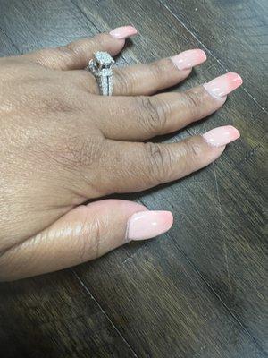 Big bulky out of shape nails