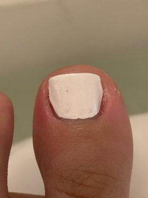 cut the side of my toe