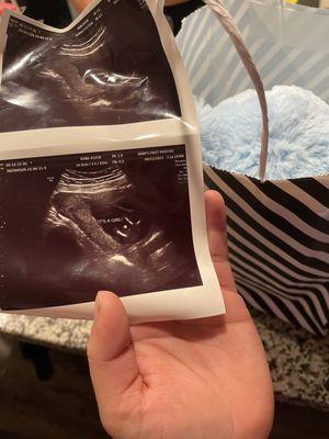 The ultrasound was showing it was a girl but during the reveal it was shown that it was a boy.