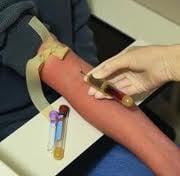 Phlebotomy draws/blood-drawing skills.