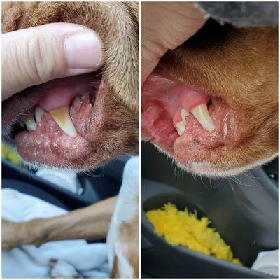 Before & After deep teeth cleaning.