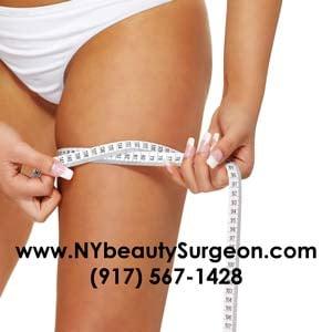 Thigh Lift, Lose weight, liposuction