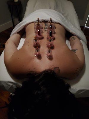 Cupping