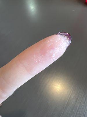 My finger, including my nail, was sanded loosening skin..