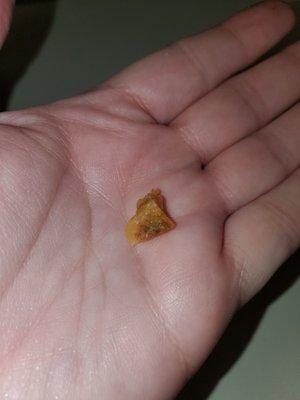 Bone shard found in food