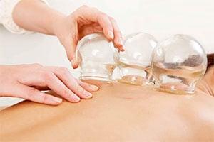 Kristin Lundeen Acupuncture offers more than just acupuncture. Heard of cupping? Want to give it a try?