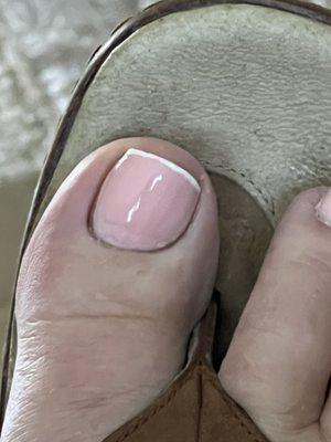 My right big toe.