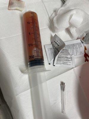 Needle with fluid