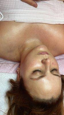 Peel facial