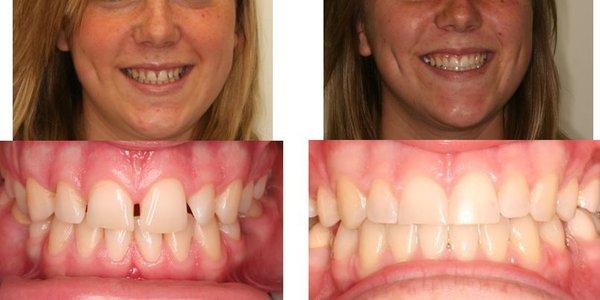 Never a dull moment with this patient! Your results look great, Katie!