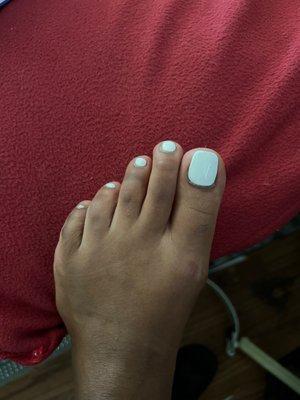 Wack ass pedicure