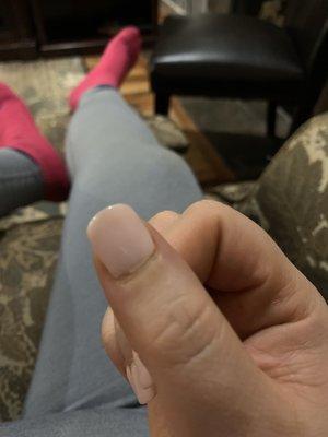 Chips around cuticle