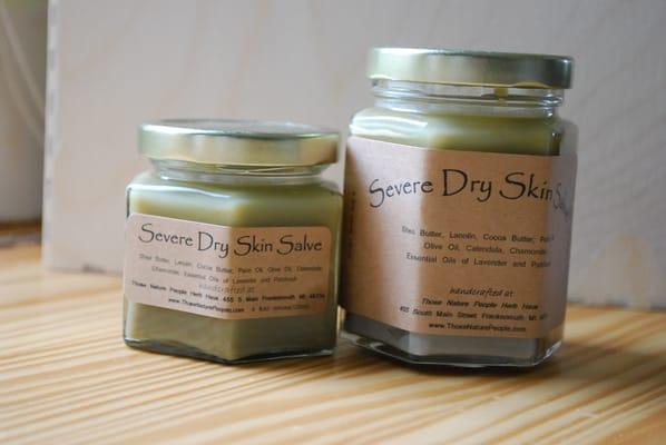 Severe Dry Skin Salve - Great for dry, cracked, bleeding skin and flaky skin.