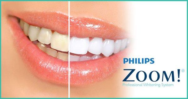 Imagine your whiter smile with Zoom Whitening! 50% off original price.