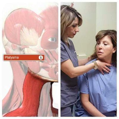 ART treatment for neck pain focusing on the platysma muscle