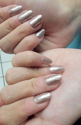 My daughter's set, look at the cuticles wasn't polished, and the gel was not evenly applied.