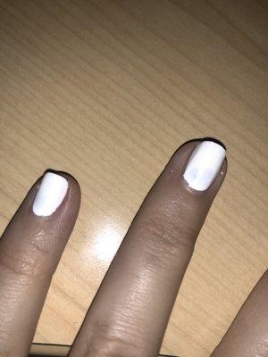 Discoloration on ring finger