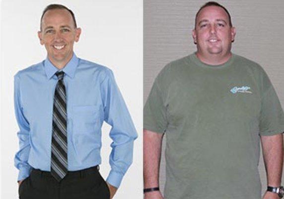 Michael lost 145 pounds with sleeve gastrectomy.