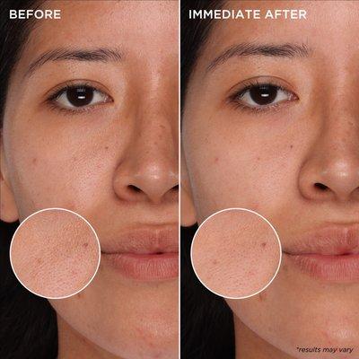 Results after 1 use! Get pores that feel deeply purified and skin that clears over time!