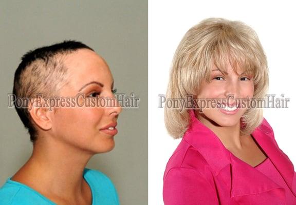 Albuquerque Hair Extensions & Hair Replacement Salon