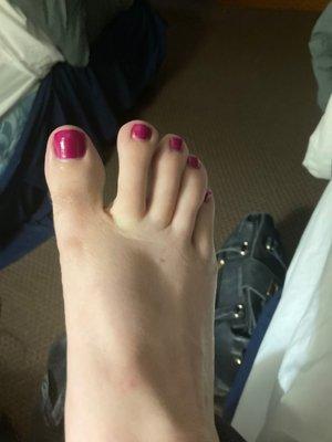 My wine-colored pedicure