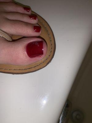 Cut my toe, hurts badly