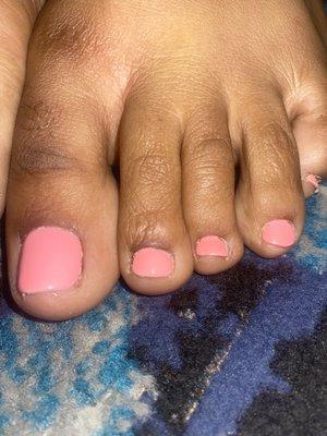 Messy nail polish in cuticle area and incomplete color on middle and pinky toe