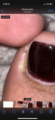 INFECTED TOE BECAUSE THEY FUCKED MY TOE UP. THEY ARE UNSANITARY AND UNSAFE. I REPORTED THEM TO THE DBPR.