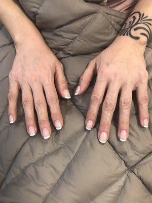 Gel overlay fill