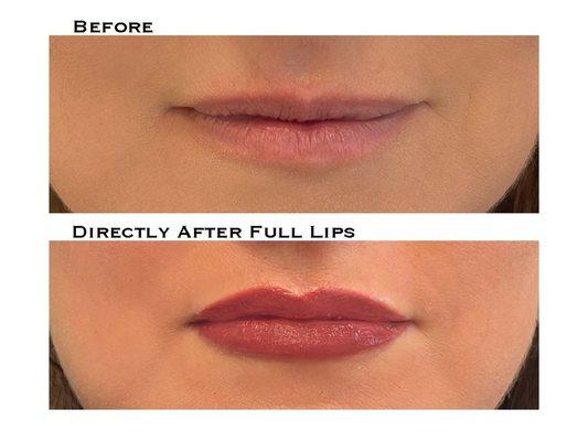 A natural tattooed Full Lip adds symmetry and consistent color