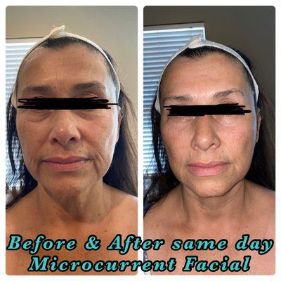 Before & After same day Microcurrent Facial!