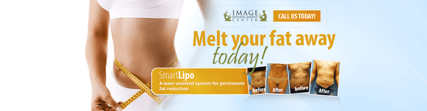 SmartLipo - Laser Liposuction