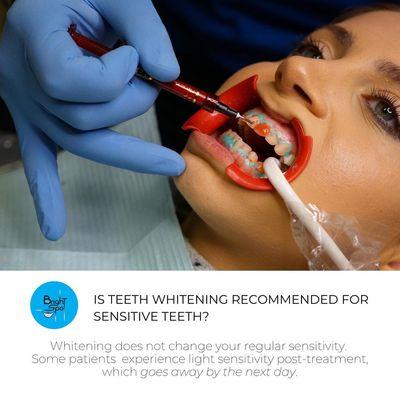 We love answering your frequently asked questions!  ​No, teeth whitening does not make your teeth more or less sensitive.